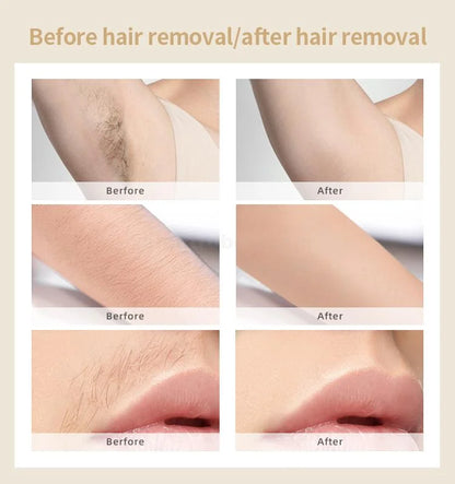 IPL Hair Removal جهاز نزع الشعر IPL